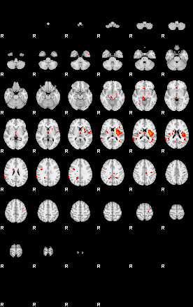 Patients 29291 81