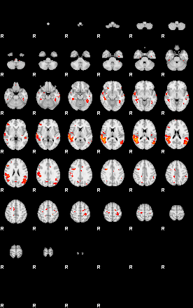 Patients 28691 43