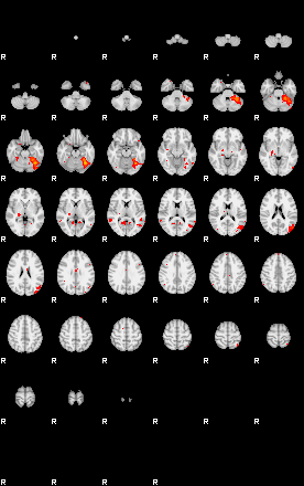 Patients 29155 135