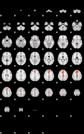 Patients 29007 6