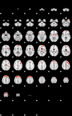 Patients 29010 93