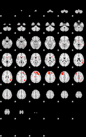 Patients 29013 131