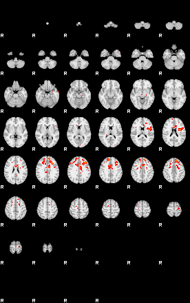 Patients 29097 14