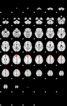 Patients 29167 58