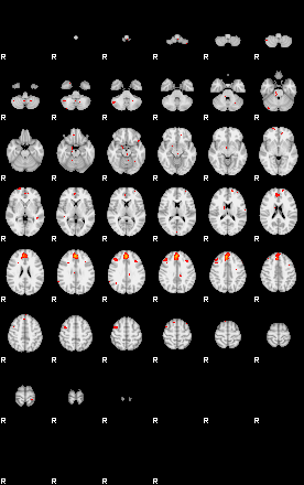 Patients 29177 62