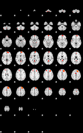 Patients 29200 105