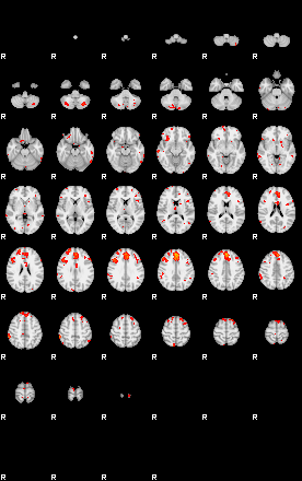 Patients 29207 50