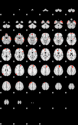 Patients 29212 17