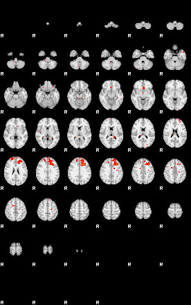 Patients 29870 4