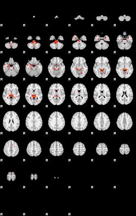 Patients 29284 149