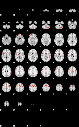 Patients 29200 59