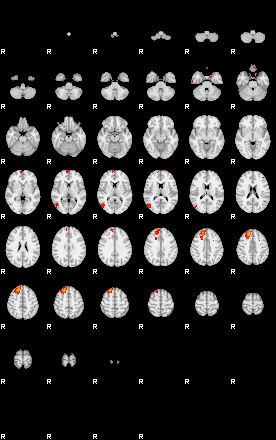 Patients 29175 190