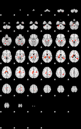 Patients 28677 96