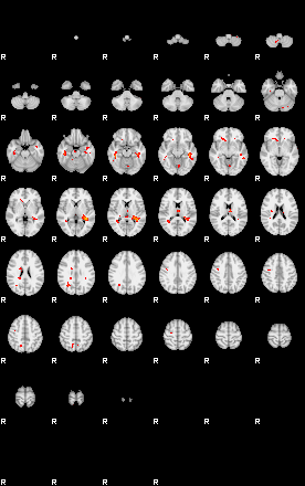 Patients 28689 95