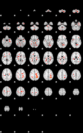 Patients 28692 96