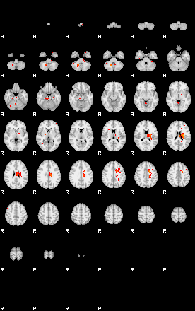 Patients 28694 4