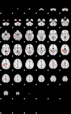 Patients 28790 188