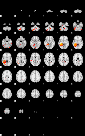 Patients 28819 139