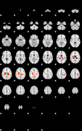 Patients 28871 25