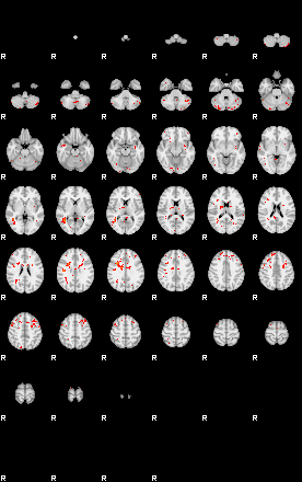 Patients 28933 194