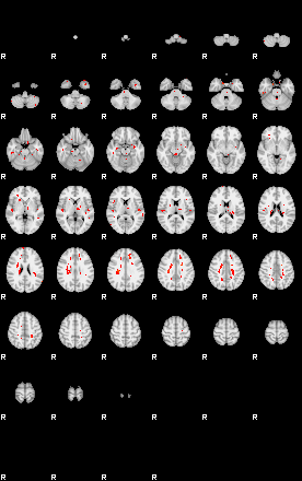 Patients 28987 4