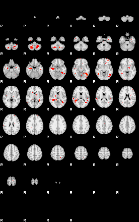 Patients 29007 152