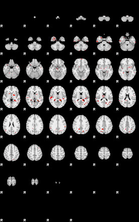 Patients 29007 75