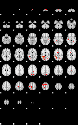 Patients 29010 125