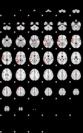 Patients 29010 16