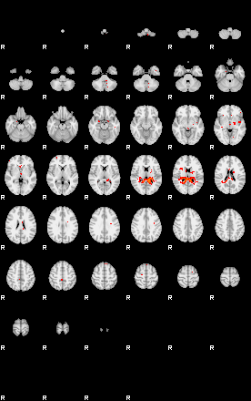 Patients 29010 163