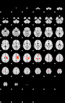 Patients 29013 188