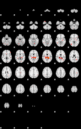 Patients 29015 148