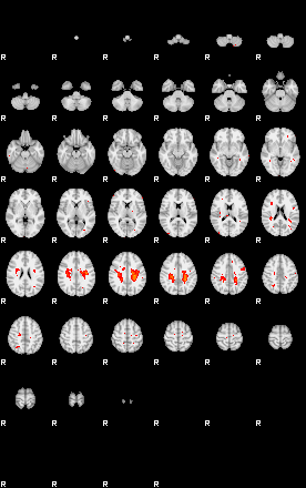 Patients 29015 175