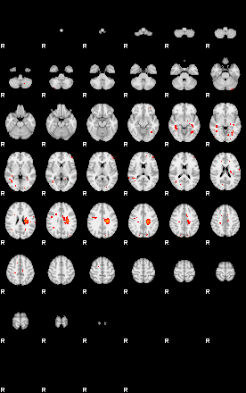 Patients 29029 172