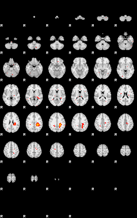 Patients 29030 182