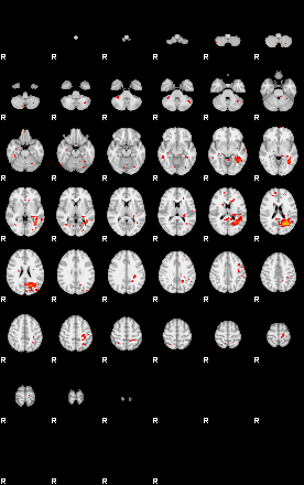 Patients 29052 25