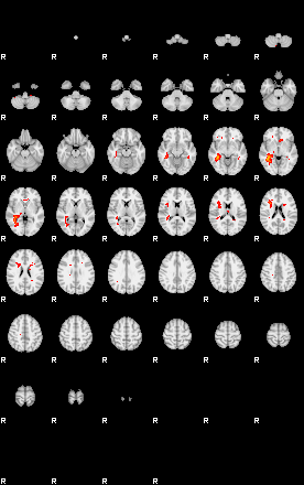 Patients 29065 135