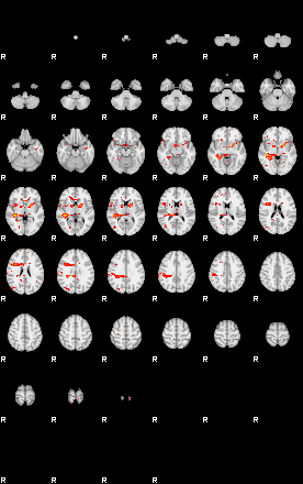 Patients 29069 98