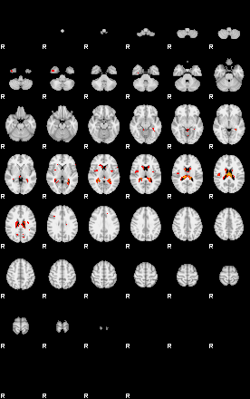 Patients 29102 48