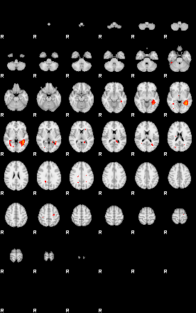 Patients 29105 192