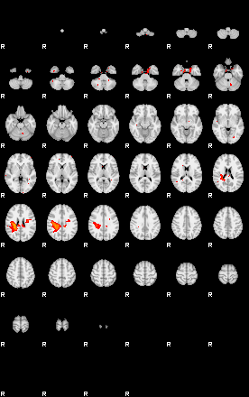 Patients 29107 165