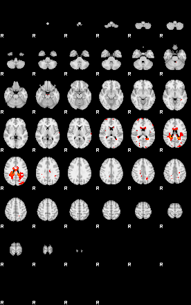 Patients 29110 156