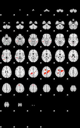 Patients 29112 4