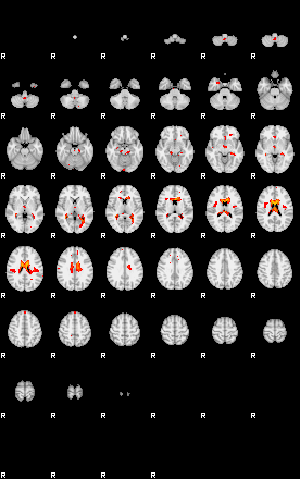 Patients 29116 138