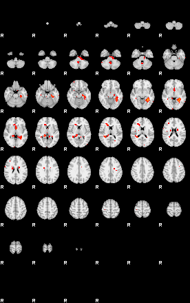 Patients 29150 27