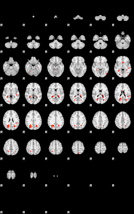 Patients 29153 163