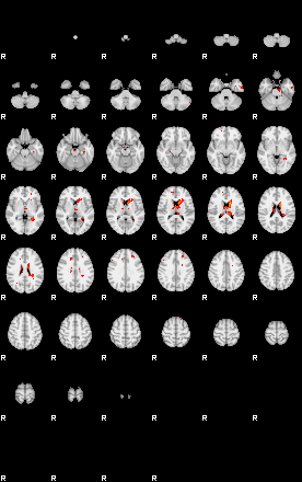 Patients 29155 52