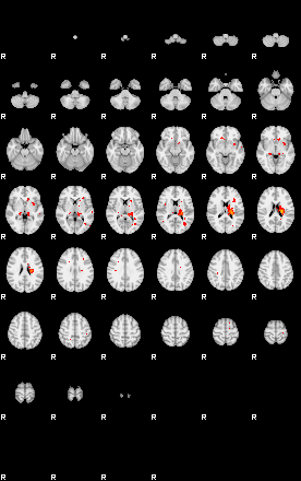 Patients 29156 3