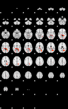 Patients 29158 23