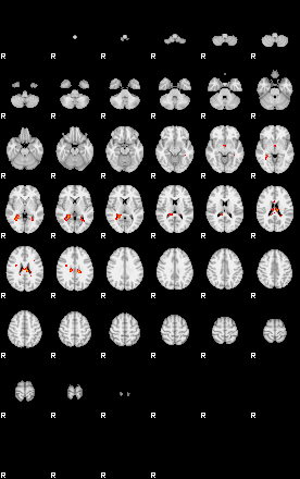 Patients 29161 89